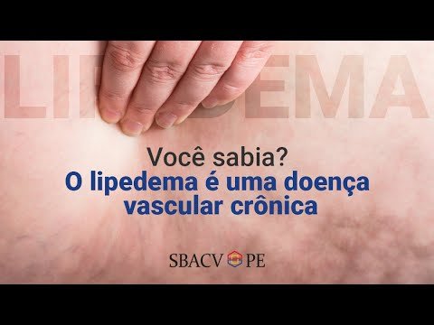 Vídeo: Você pensa que é gordura ou retenção? Pode ser Lipedema — matéria do Fantástico